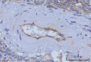 Thrombomodulin/THBD Rabbit Polyclonal Antibody