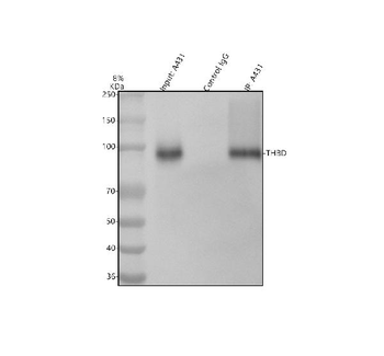 Thrombomodulin/THBD Rabbit Polyclonal Antibody
