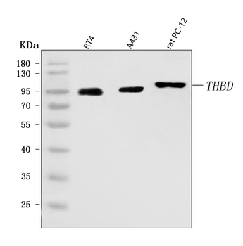 Thrombomodulin/THBD Rabbit Polyclonal Antibody