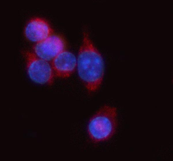 Tap1 Rabbit Polyclonal Antibody