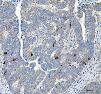 Chromogranin A/CHGA Rabbit Polyclonal Antibody