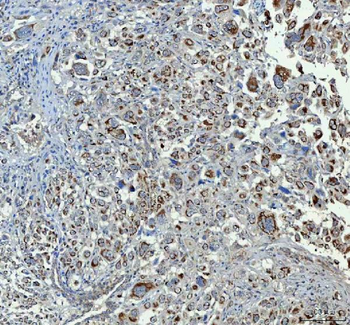 Chromogranin A/CHGA Rabbit Polyclonal Antibody