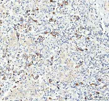 Chromogranin A/CHGA Rabbit Polyclonal Antibody