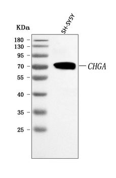 Chromogranin A/CHGA Rabbit Polyclonal Antibody
