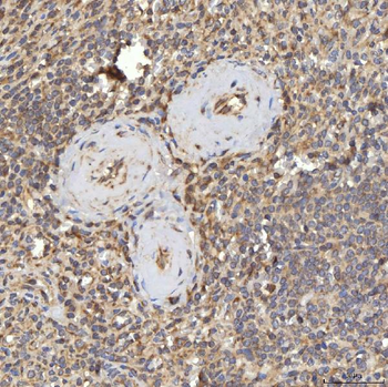RBMS1 Rabbit Polyclonal Antibody