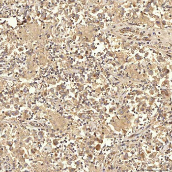 RBMS1 Rabbit Polyclonal Antibody