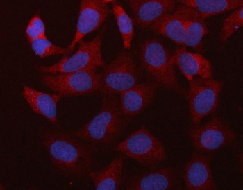 RBMS1 Rabbit Polyclonal Antibody