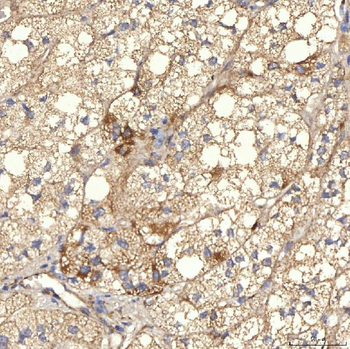 RBMS1 Rabbit Polyclonal Antibody