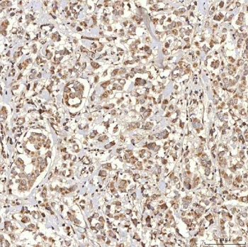 RBMS1 Rabbit Polyclonal Antibody