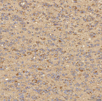 RBMS1 Rabbit Polyclonal Antibody