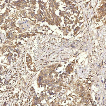 RBMS1 Rabbit Polyclonal Antibody