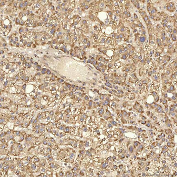 RBMS1 Rabbit Polyclonal Antibody