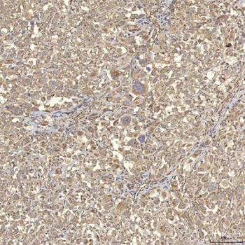 RBMS1 Rabbit Polyclonal Antibody
