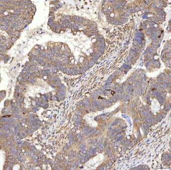 RBMS1 Rabbit Polyclonal Antibody