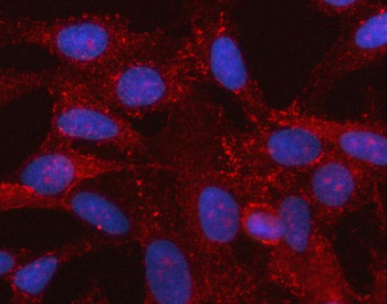 SPOCK3 Rabbit Polyclonal Antibody