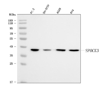 SPOCK3 Rabbit Polyclonal Antibody