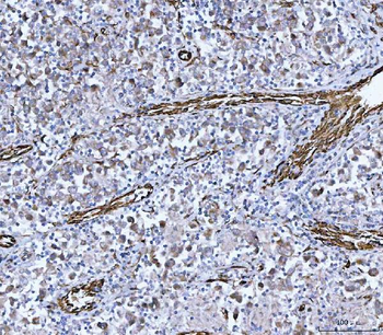 PTRF/CAVIN1 Rabbit Polyclonal Antibody