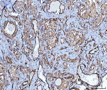 PTRF/CAVIN1 Rabbit Polyclonal Antibody