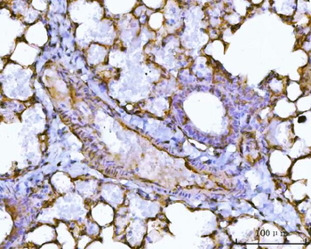 PTRF/CAVIN1 Rabbit Polyclonal Antibody