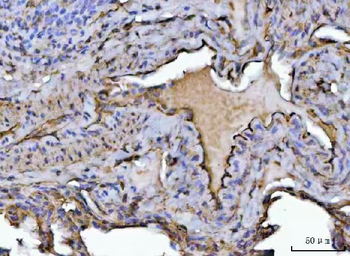 PTRF/CAVIN1 Rabbit Polyclonal Antibody