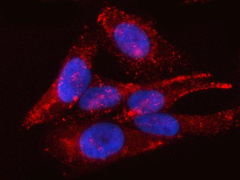 PTRF/CAVIN1 Rabbit Polyclonal Antibody