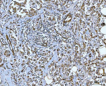 PTRF/CAVIN1 Rabbit Polyclonal Antibody