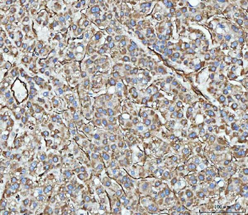 PTRF/CAVIN1 Rabbit Polyclonal Antibody