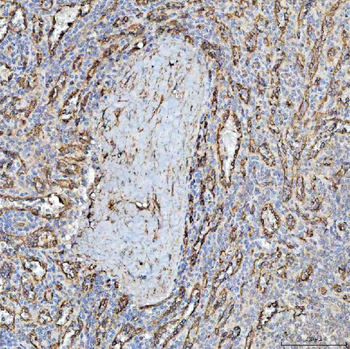 PTRF/CAVIN1 Rabbit Polyclonal Antibody