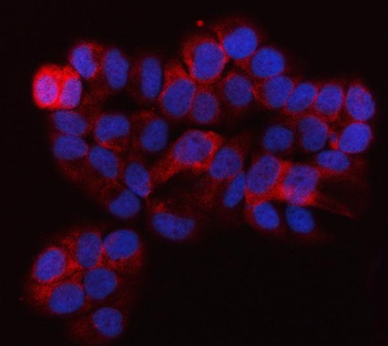QARS1 Rabbit Polyclonal Antibody