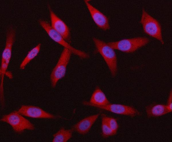 HRD1/SYVN1 Rabbit Polyclonal Antibody