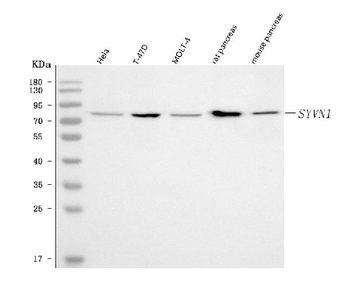 HRD1/SYVN1 Rabbit Polyclonal Antibody