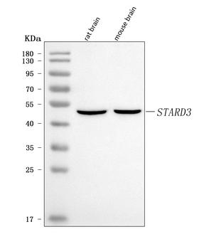 MLN64/STARD3 Rabbit Polyclonal Antibody