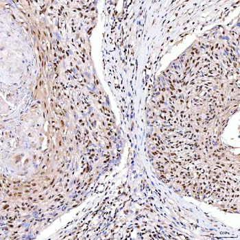 ARS2/SRRT Rabbit Polyclonal Antibody