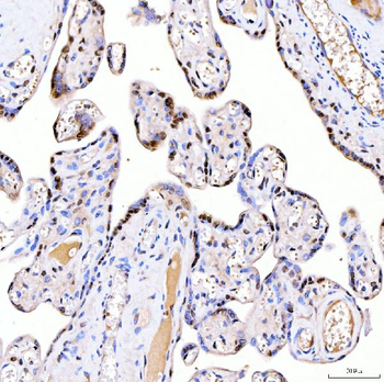 ARS2/SRRT Rabbit Polyclonal Antibody