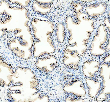 ARS2/SRRT Rabbit Polyclonal Antibody