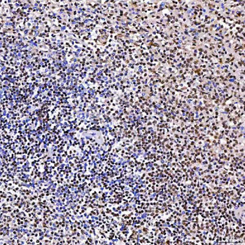 ARS2/SRRT Rabbit Polyclonal Antibody