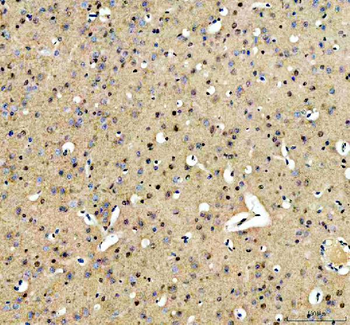 ARS2/SRRT Rabbit Polyclonal Antibody