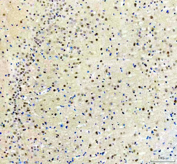 ARS2/SRRT Rabbit Polyclonal Antibody