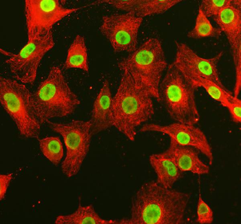 ARS2/SRRT Rabbit Polyclonal Antibody