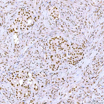 ARS2/SRRT Rabbit Polyclonal Antibody