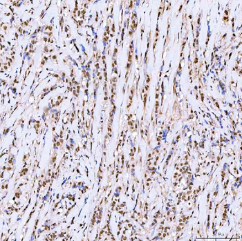 ARS2/SRRT Rabbit Polyclonal Antibody