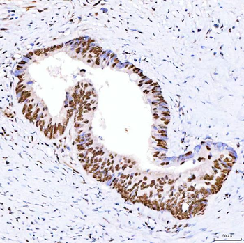 ARS2/SRRT Rabbit Polyclonal Antibody