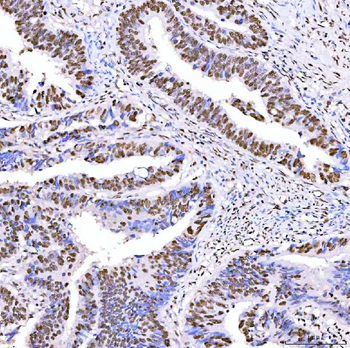 ARS2/SRRT Rabbit Polyclonal Antibody