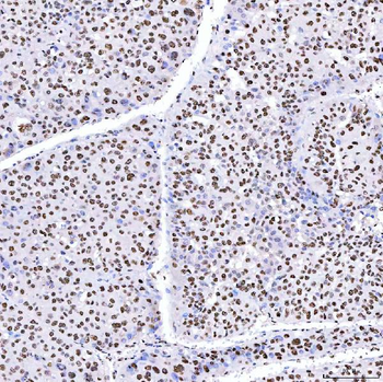 ARS2/SRRT Rabbit Polyclonal Antibody