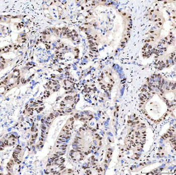 ARS2/SRRT Rabbit Polyclonal Antibody