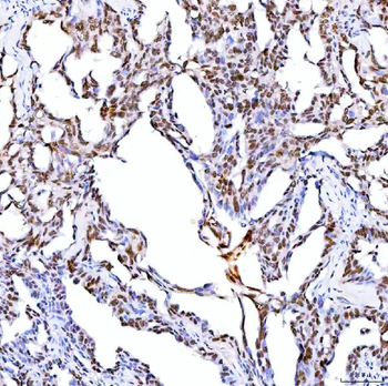 ARS2/SRRT Rabbit Polyclonal Antibody