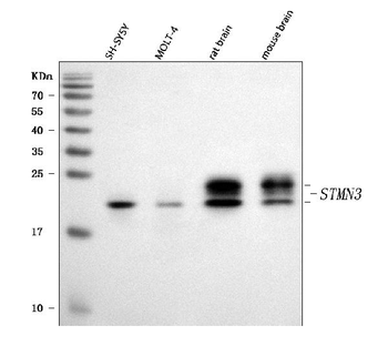 STMN3 Rabbit Polyclonal Antibody