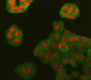 Symplekin/SYMPK Rabbit Polyclonal Antibody