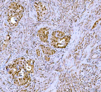 Symplekin/SYMPK Rabbit Polyclonal Antibody
