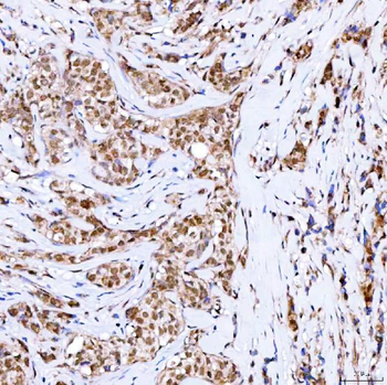 Symplekin/SYMPK Rabbit Polyclonal Antibody